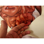 Тренажер аппендэктомии и пальпации IV-append