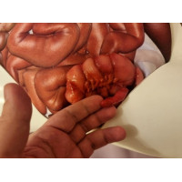 Тренажер аппендэктомии и пальпации IV-append