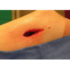 Тренажёр закрытия раны