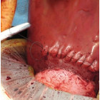 Набор маток и брюшных вставок для тренажёра полноцикла родов с применением кесарева сечения (C-Celia)