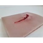 Хирургический модуль травмы