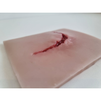 Хирургический модуль травмы